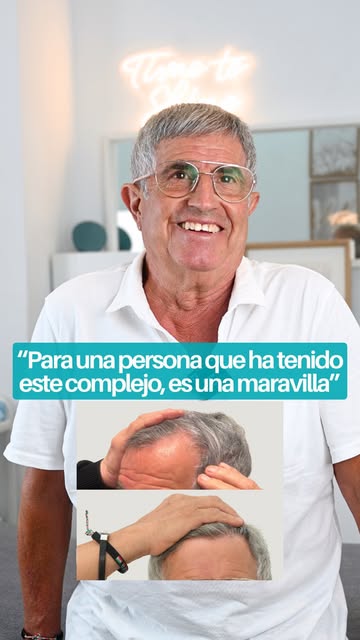 ¿Cómo se vive realmente un injerto capilar?

Emiliano ya ha pasado por todo el proceso y hoy nos cue