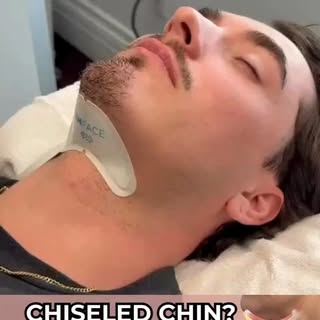 Snatch that jawline 
#EMFACE submental applicator is a non-invasive treatment designed to reduce the