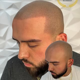 Sacramento King 👑 

Being bald is now optional. 👴✒️………..

5pmshadow.com 🔥🫡

DM for a quote and s