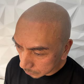 Scalp micropigmentation is magic 🪄 #hairtattoo #scalpco #hairloss #sacramento #hairtattoos