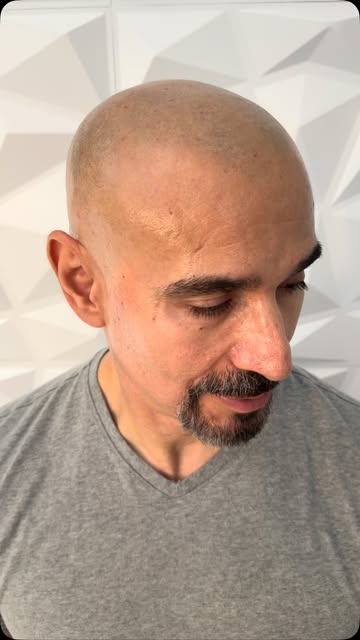 Natural. Clean. Undetectable. 🔥

Scalp Micropigmentation by John Chandler at Scalp Co Sacramento. E