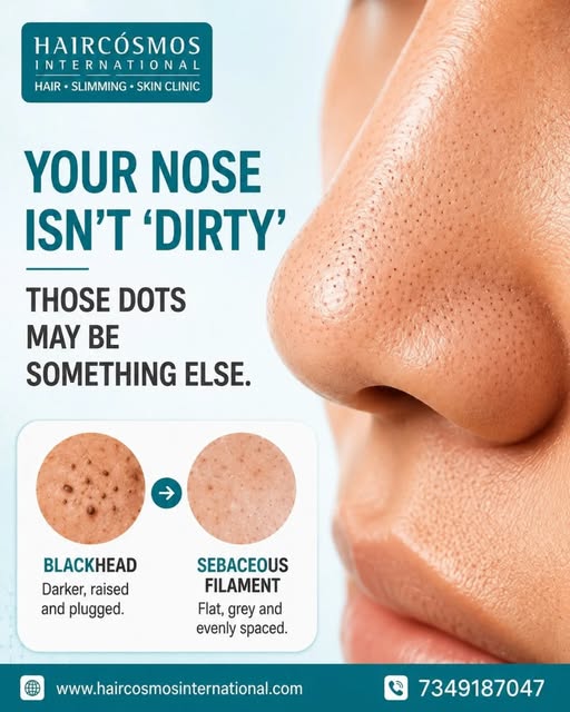 Those tiny dots on your nose may not be dirt at all! 👃✨

They could be **sebaceous filaments**—a na