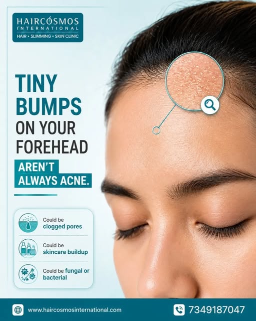 Those tiny forehead bumps might not be acne✨

From clogged pores and product buildup to fungal or ba