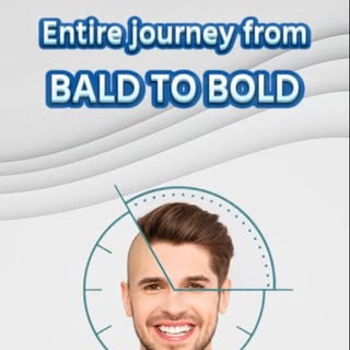 The king got his crown back

Grade 6 B baldness in a 25-year-old young man was severely affecting hi