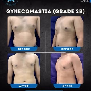 Exceptional outcomes come from expertise you can trust.
At Instar Aesthetic Surgery Center, our gyne