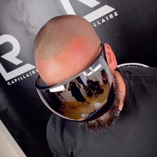 🔥 Vous en avez assez de cacher votre calvitie ?

Chaque jour, des hommes retrouvent confiance grâce