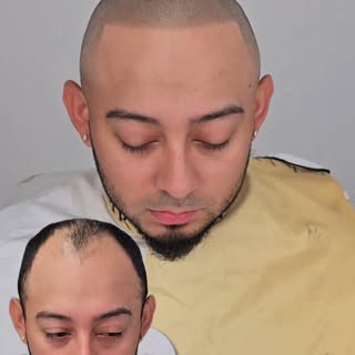 Rapado total → Esto fue lo que hicimos😱

Este cliente decidió raparse por completo lo que le quedab