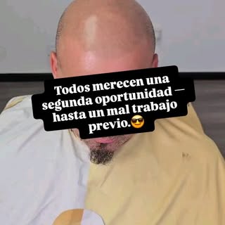 Reparación y Retoque de SMP😱

Si buscas mejorar tu tratamiento comunícate conmigo al 908-759-3529 �