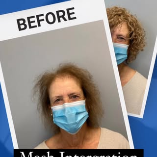 Get your confidence back!

Losing your hair can feel like the absolute worst, but I’m beyond excited