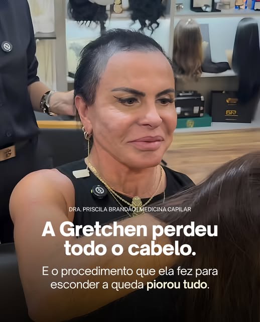 O caso da Gretchen escancarou algo que acontece com muitas mulheres: a tentativa de
disfarçar a qued