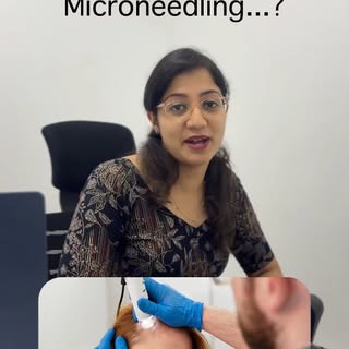 What is scalp microneedling...?
.
.
.
#skincare #Microneedling #hairtreament