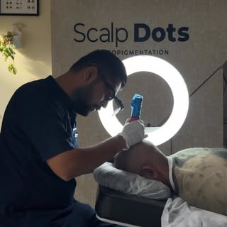 ✨ From Bald to Bold! ✨
Scalp micropigmentation 
#scalpmicropigmentation #smp #scalpmicropigmentation