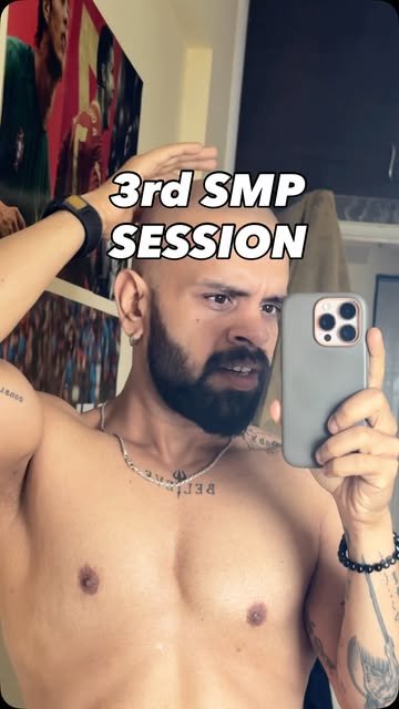 Added the results after 3rd Scalp Micro Pigmentation session. 1 more to go.. will be posting the ent