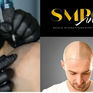 ⏰️ Model Call 📣 📸 please share 🙂

🔎 Looking for Models for 
👨‍🦲 Scalp Micropigmentation
⏳️ Ide