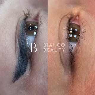 From wings to clean girl aesthetic with Bianco Beauty 💛

Eyeliner laser tattoo removal is an extrem