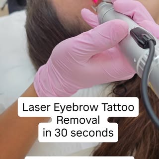 Looking to remove your unwanted microblading?
Not sure what to expect during the treatment?

Watch t