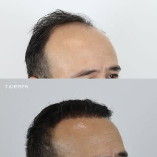 7 meses después… y el cambio habla por sí solo ✨
Paciencia, constancia y confianza en el proceso. Ho