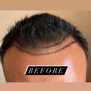 All I want for Christmas is my hairline back ! 😉🎄🎁✨
Happy December 1st everyone! Here are more be
