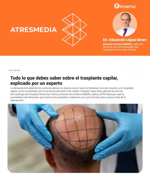 Gracias a @atresmediacom por este reportaje sobre el trasplante capilar, un tratamiento cada vez más