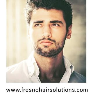 Non-Surgical Hair Replacement for men and women. Call for a free consultation 559-248-2700