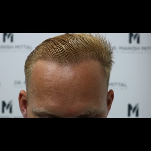 And the front just incase