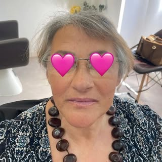 O nosso último trabalho fala por si.
Da ausência de cabelo à recuperação da imagem, existe uma difer