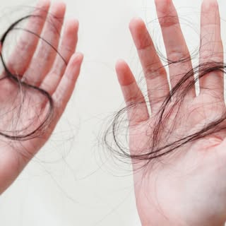 🌱 Queda de cabelo não é 'coisa de homem' ou 'de mulher' – é um problema COMUM! 🌱

Na nossa avaliaç