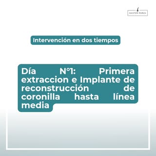Hoy les vengo a traer un caso especial 🧐 Se trata de un paciente joven en quien se realizó una ciru