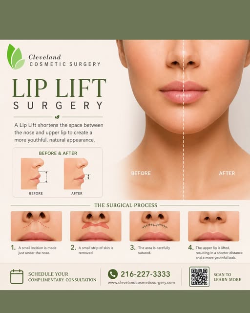 ✨ A subtle change can make a remarkable difference.

A lip lift is designed to shorten the distance 