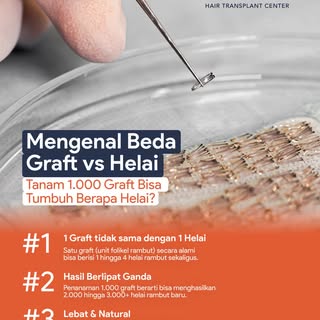 Tanam 1.000 graft = 1.000 helai rambut? Mitos! ❌ 

1 graft itu unit folikel yang berisi 1–4 helai ra