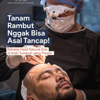 Tanam rambut gak bisa asal tancap! Rahasia hasil lebat dan natural ada di Seni Angulasi yaitu keahli