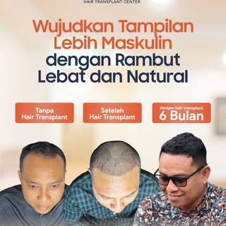 Impian punya rambut tebal & natural bukan cuma angan-angan! Lewat proses yang tepat, kamu bisa melih