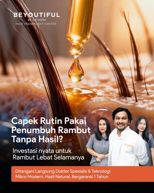 Capek gonta-ganti hair growth treatment tapi hasilnya gitu-gitu aja?

Saatnya upgrade ke solusi perm