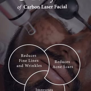 WHAT IS HYDRAFACIAL?

A carbon facial, also known as a carbon laser facial or carbon peel, is a skin