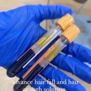 Are you suffering from hair loss and want to get your roots back to strength? 

We have a perfect so