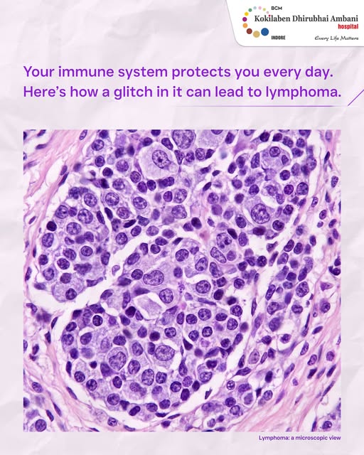 Your body’s defence system can sometimes need support too.

Lymphoma is a cancer that affects the ce