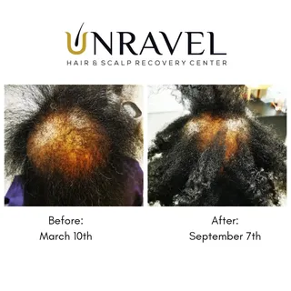 Need Help? Hair Loss?

Click link in bio for more information👇🏼
.
.
.
.
.
#hair #body #mind #aroma