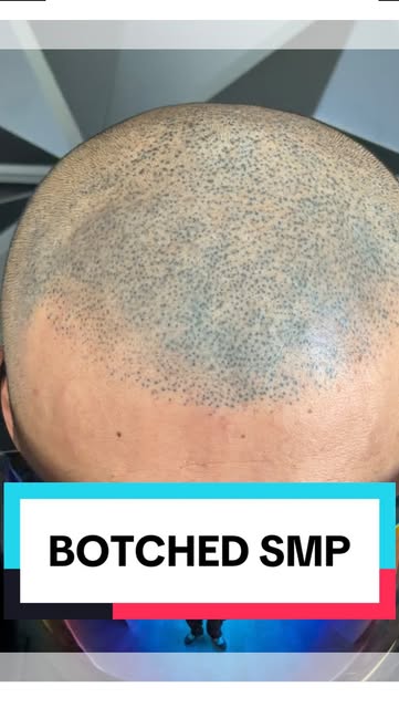 Another SMP correction in the works. 🎯

This client previously had SMP performed by someone in the 