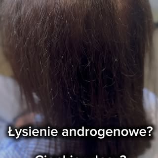 Cienkie włosy? Łysienie androgenowe? Nie musisz się z tym godzić! ✂️✨

Zmagasz się z przerzedzeniem 