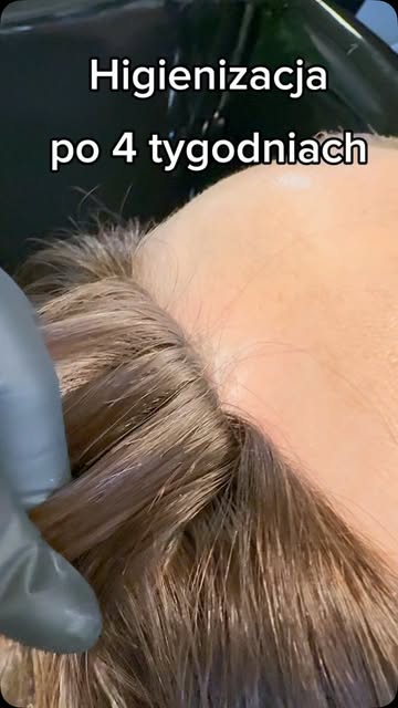 Czas na serwis! 💇‍♂️✨ Co dzieje się z systemem włosów po około 4 tygodniach?
Regularna higienizacja
