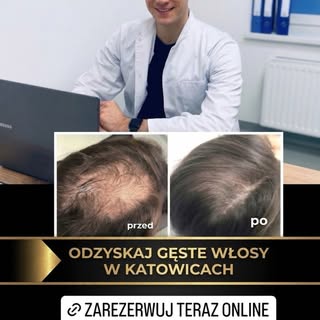 Umów się na konsultacje z badaniem trychologicznym w cenie 140zl!

Skuteczne leczenie wypadania włos
