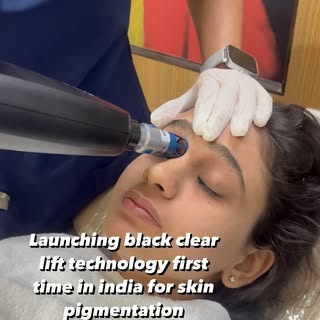 The latest and most advanced technology which  target all layers pigmentation in single session@ Alm