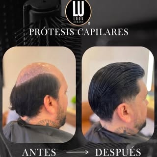 Recuperar el cabello también es recuperar la confianza😉 

Por eso, en Look Urbano trabajamos para l