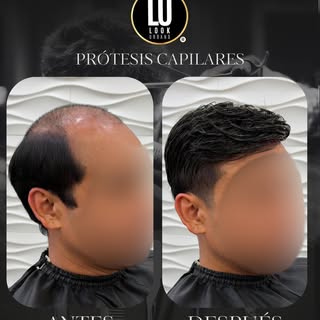 Del antes al después, con un resultado que habla por sí solo🤩

Naturalidad, comodidad y un look pen