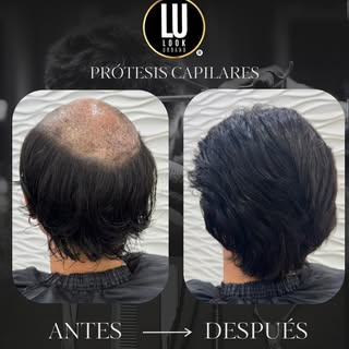 Un resultado natural🙌🏼
Así quedó esta transformación, logrando un look renovado y adaptado a su es