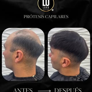 Antes ➡️ Después

Un cambio que renueva la imagen y devuelve la seguridad para sentirse bien todos l
