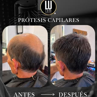 Resultados que se ven, confianza que se siente🤝🏻

En este caso, logramos un resultado natural, mod