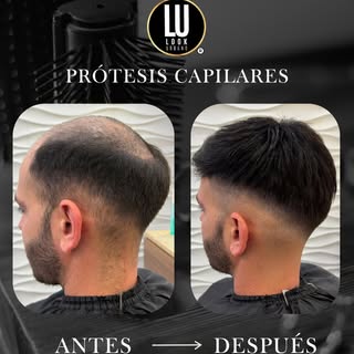 Resultados naturales que hacen la diferencia🙌🏼

Si estás buscando una solución capilar, agendá tu 