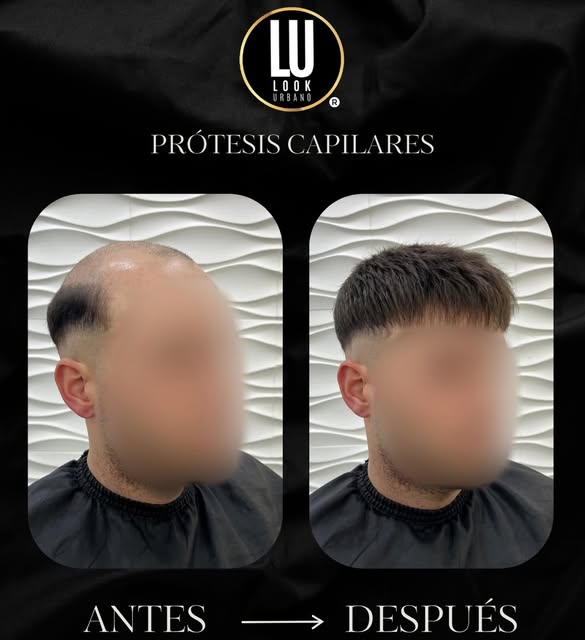 La diferencia está en los detalles🙌🏼

Un resultado natural que transforma mucho más que la imagen�