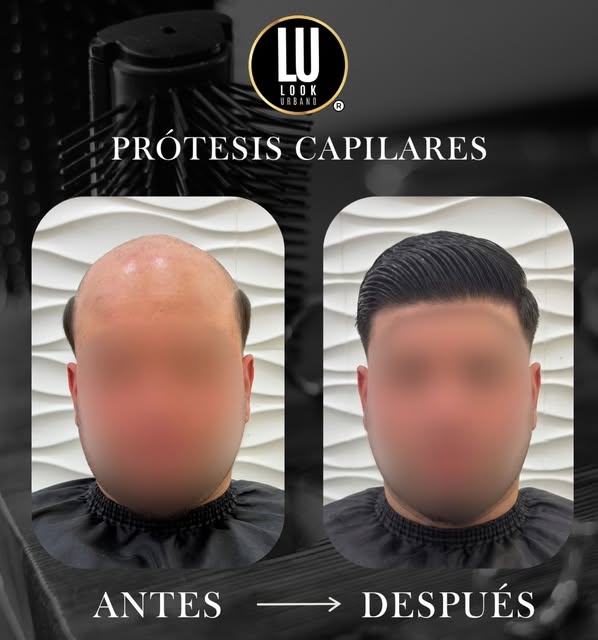 No es solo un cambio de imagen, es volver a sentirte vos🫵🏻

Cada detalle está pensado para consegu